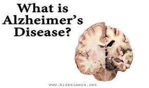 effect of alzheimer's disease