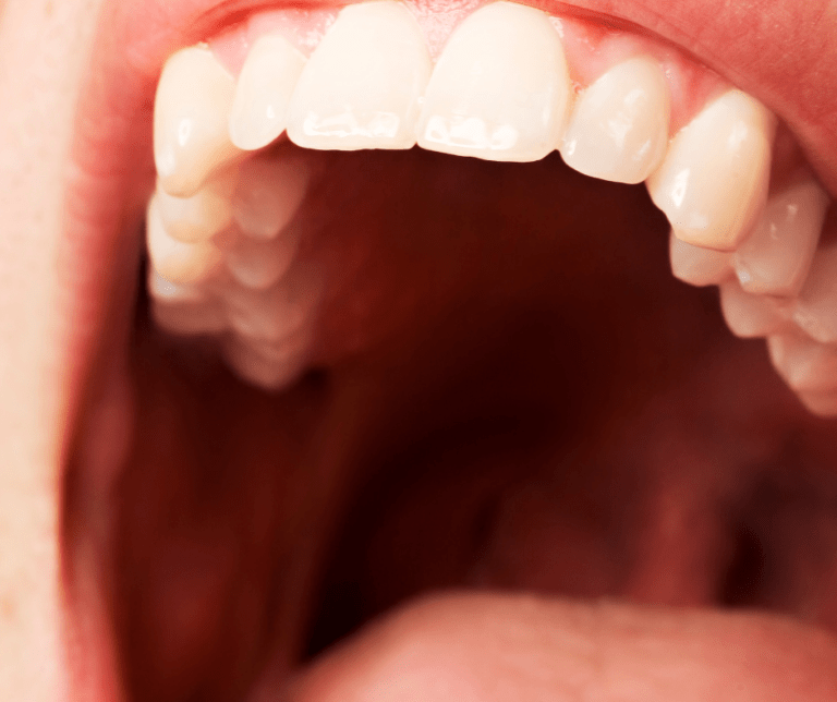 roof-of-mouth-itchy-common-sign-5-causes-and-treatment