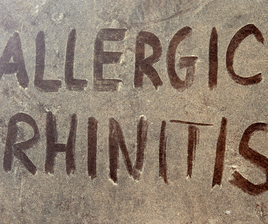  allergenic Rhinitis