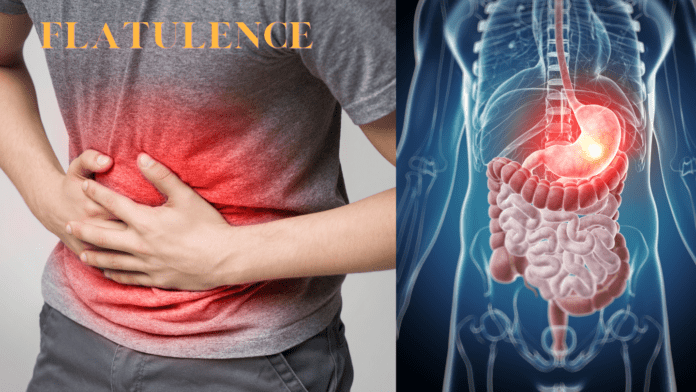 Flatulence or Gas Gone: 10 Secrets to Relief